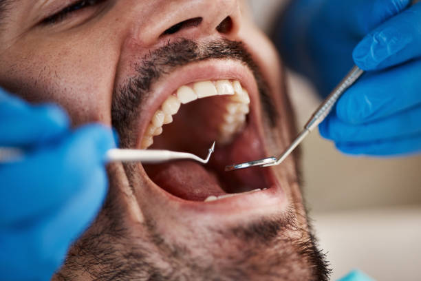 Best Emergency Dental Services for Seniors in Lindenwold, NJ